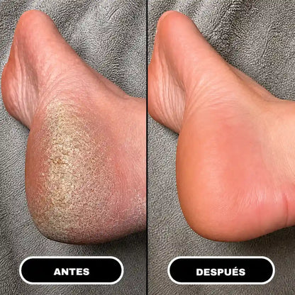 Suavin | Crema Reparadora con Urea 60% para Pies Secos y Agrietados