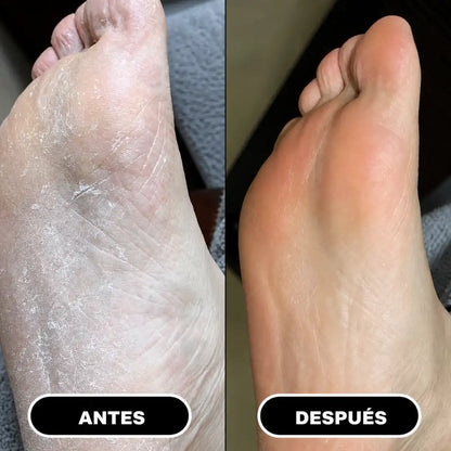 Suavin | Crema Reparadora con Urea 60% para Pies Secos y Agrietados